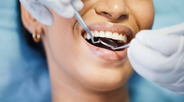 Best Urgent Care for Lost Fillings or Crowns in Heath, TX