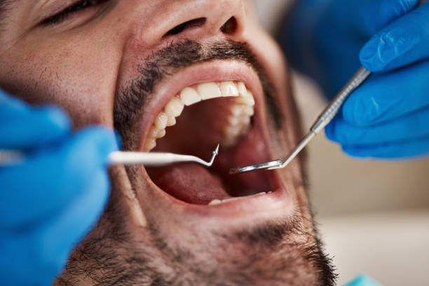 Best Emergency Gum Treatment in Heath, TX