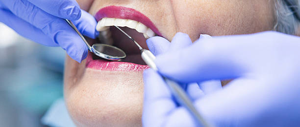 Best Emergency Dental Care for Broken or Chipped Teeth in Heath, TX